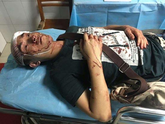 公交司机不让老人从后门上 被砸头血流满面(图)